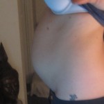 IBS Irritable Bowel Syndrome and me